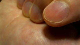 改善した右手人差し指の爪